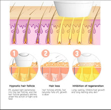 Load image into Gallery viewer, IPL Laser Hair Removal - Pink_4